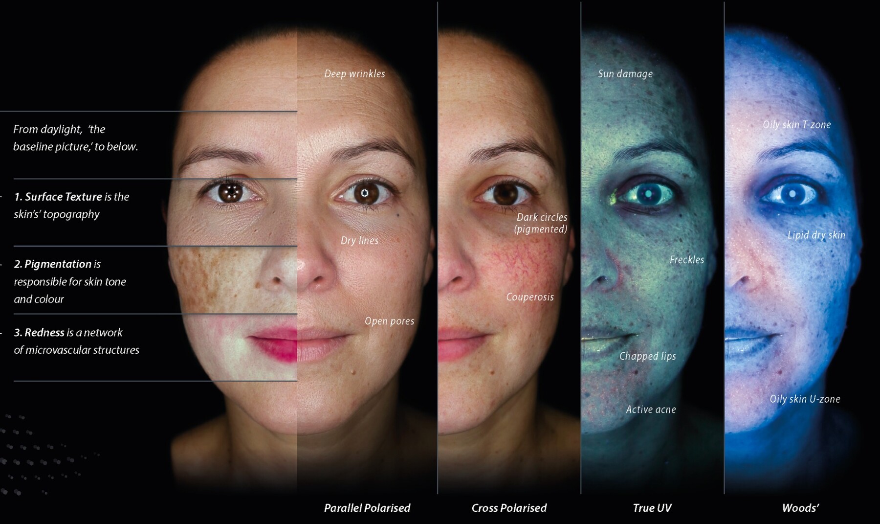 Different OBSERV 520x imaging modes showing skin texture, pigmentation, redness, sun damage and oil distribution